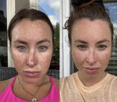 I’ve actually had insane results on this! My skin looks amazing and my hair growth is insane! My digestive system has been insane since using the collagen, and I can usually only do OrangeTheory three times a week. Since using the Collagen I went five days in a row.